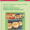 Adhesive Restoration Of Endodontically Treated Teeth