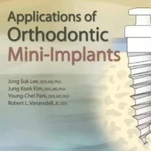 Applications Of Orthodontic Mini Implants