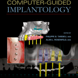 Art Of Computer-Guided Implantology