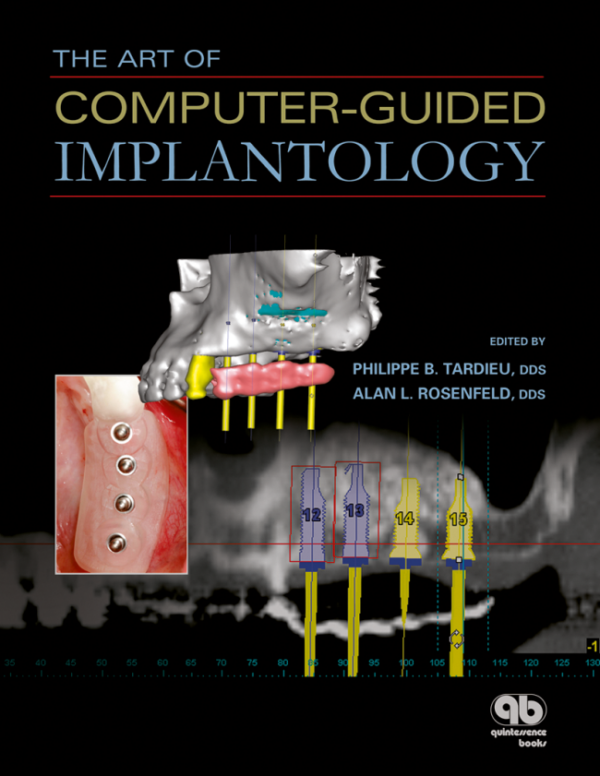 Art Of Computer-Guided Implantology