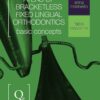 Atlas Of Bracketless Fixed Lingual Orthodontics: Basic Concepts