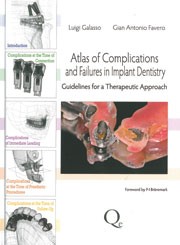 Atlas Of Complications And Failures In Implant Dentistry: Guidelines For A Therapeutic Approach