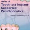 Atlas Of Tooth & Imp-Supp Prosthodontics