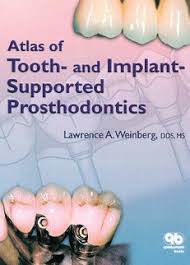 Atlas Of Tooth & Imp-Supp Prosthodontics