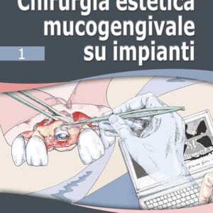 Chirurgia Estetica Mucogengivale