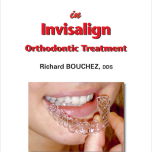 Clinical Success In Invisalign Orthodontic Treatment