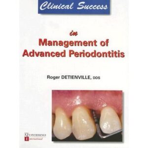 Clinical Success In Mngmt Of Advanced Periodontitis